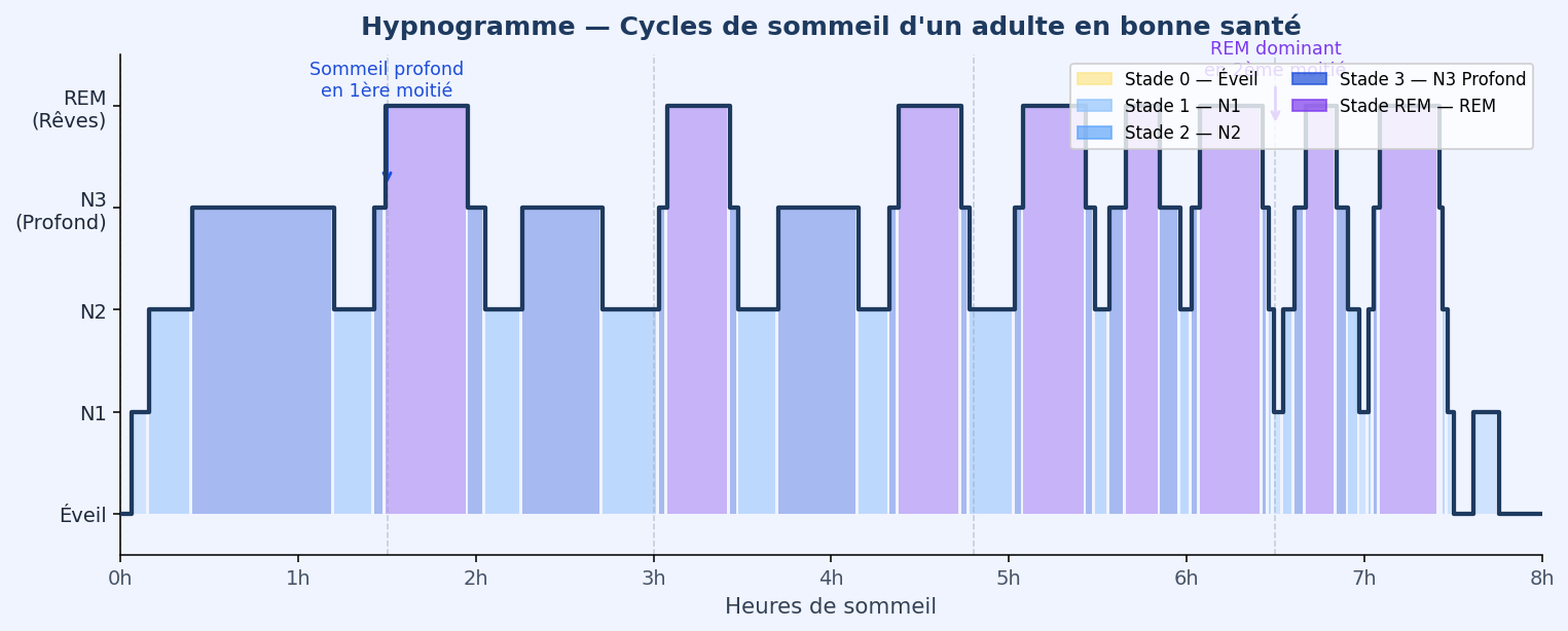 Hypnogramme d'une nuit de sommeil type — cycles N1/N2/N3 et REM sur 8h. Le somme
